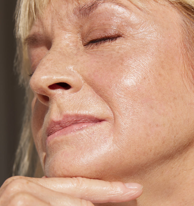 no surgery rhinoplasty