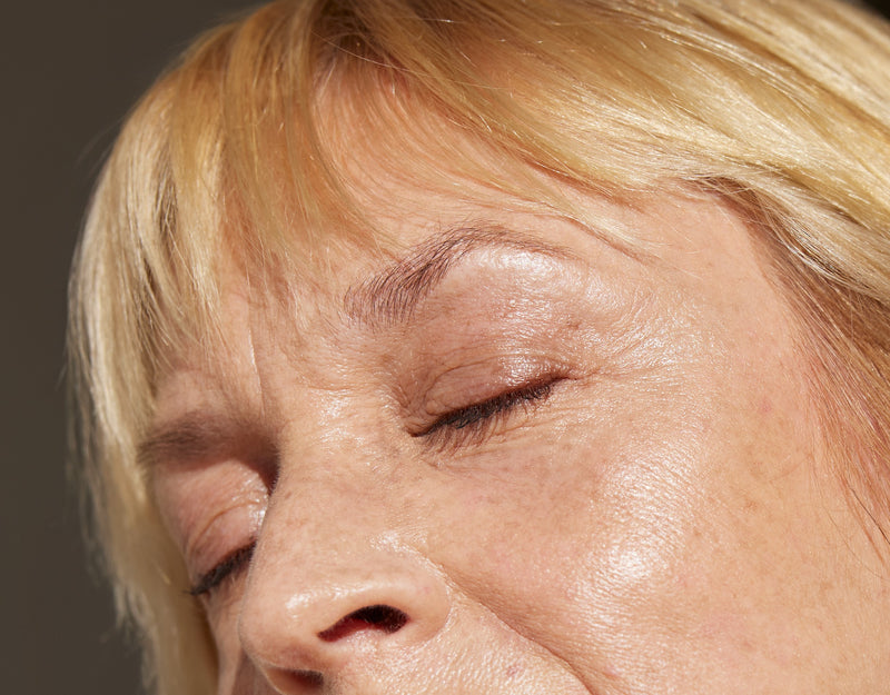best eyebrow lift sydney