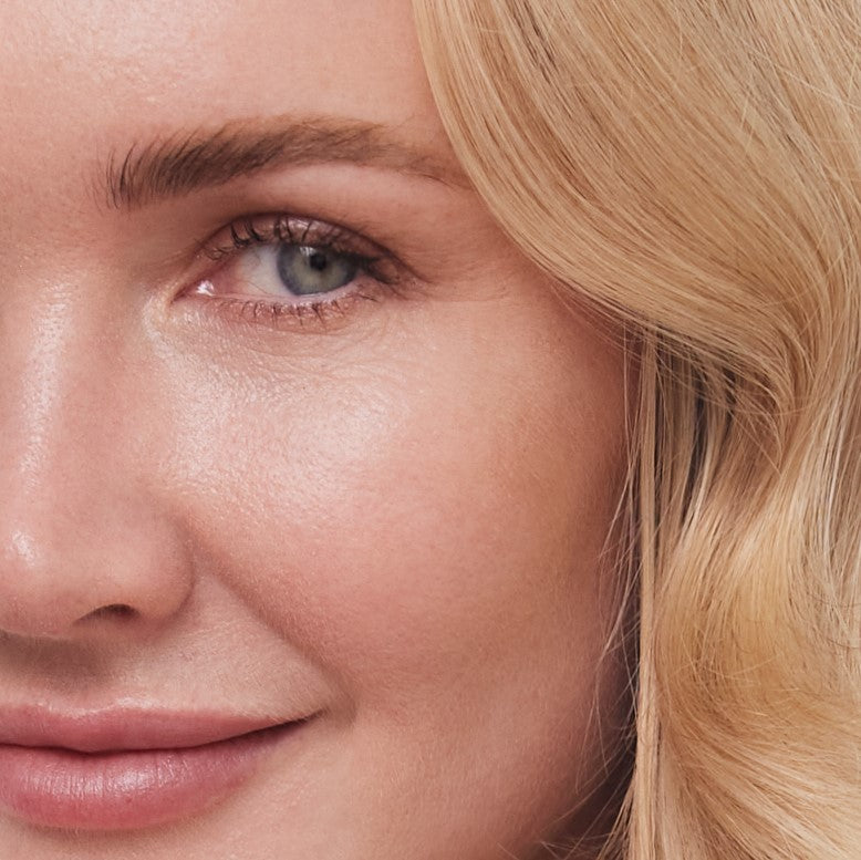 get rid of crows feet