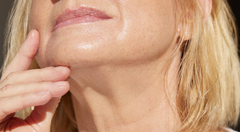 jawline filler in sydney