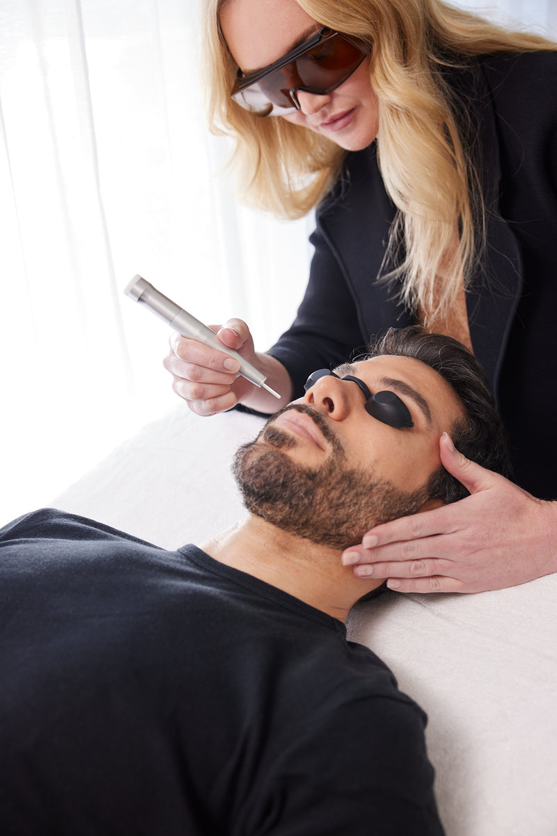 laser for facial redness