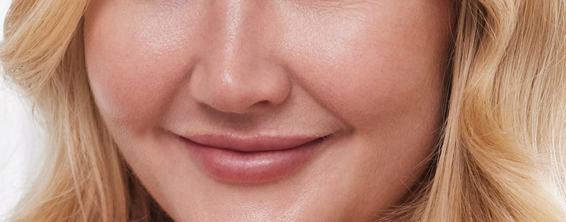 cheek filler sydney
