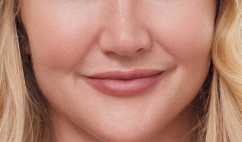 best lip filler in sydney