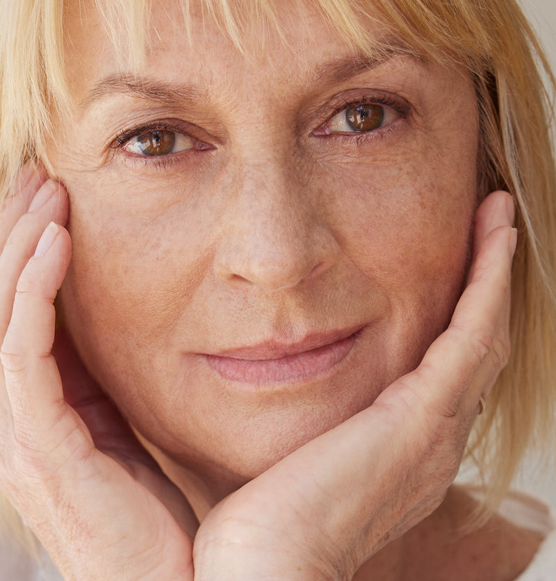 nasolabial folds filler