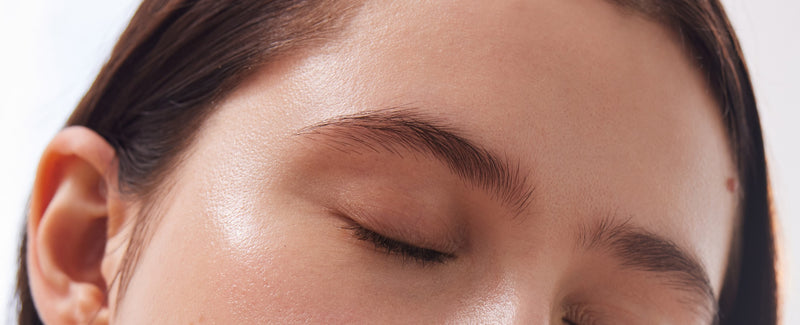 forehead fillers